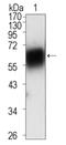 Receptor Tyrosine Kinase Like Orphan Receptor 1 antibody, AM06399SU-N, Origene, Western Blot image 