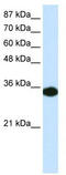 Homeobox D4 antibody, TA329260, Origene, Western Blot image 