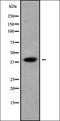 KH RNA Binding Domain Containing, Signal Transduction Associated 3 antibody, orb338394, Biorbyt, Western Blot image 