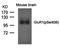 Glutamate Ionotropic Receptor AMPA Type Subunit 1 antibody, orb43358, Biorbyt, Western Blot image 