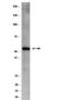 Phosphate Cytidylyltransferase 1, Choline, Beta antibody, NBP2-29807, Novus Biologicals, Western Blot image 