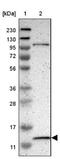 Mitochondrial Ribosomal Protein L52 antibody, NBP1-86094, Novus Biologicals, Western Blot image 