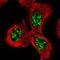 WRN RecQ Like Helicase antibody, NBP1-87143, Novus Biologicals, Immunocytochemistry image 