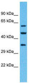 Olfactory Receptor Family 4 Subfamily F Member 6 antibody, TA337506, Origene, Western Blot image 