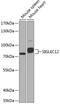 Sialic Acid Binding Ig Like Lectin 12 (Gene/Pseudogene) antibody, A10550, Boster Biological Technology, Western Blot image 