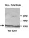 Ubiquitin Conjugating Enzyme E2 V2 antibody, orb76964, Biorbyt, Western Blot image 