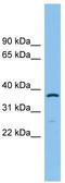Aldo-keto reductase family 1 member C2 antibody, TA337630, Origene, Western Blot image 