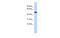 Tripartite Motif Family Like 2 antibody, MBS5302478, MyBioSource, Western Blot image 