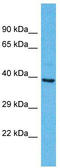 Olfactory Receptor Family 2 Subfamily A Member 25 antibody, TA337488, Origene, Western Blot image 