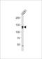 Endothelin-converting enzyme 2 antibody, LS-C203974, Lifespan Biosciences, Western Blot image 