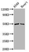 Iroquois Homeobox 6 antibody, CSB-PA011838LA01HU, Cusabio, Western Blot image 