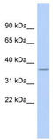 Ribosomal Protein L5 antibody, TA335157, Origene, Western Blot image 