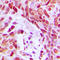 Myocyte Enhancer Factor 2D antibody, abx133089, Abbexa, Western Blot image 