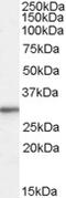 Ribosomal Protein L8 antibody, MBS421318, MyBioSource, Western Blot image 