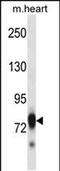 SCY1 Like Pseudokinase 3 antibody, PA5-48673, Invitrogen Antibodies, Western Blot image 