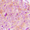 Phospholipase C Gamma 2 antibody, LS-C356255, Lifespan Biosciences, Immunohistochemistry paraffin image 