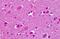 Cadherin EGF LAG seven-pass G-type receptor 2 antibody, MBS244572, MyBioSource, Immunohistochemistry paraffin image 