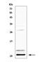 Platelet Factor 4 antibody, A00871, Boster Biological Technology, Western Blot image 