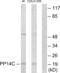 Protein Phosphatase 1 Regulatory Inhibitor Subunit 14C antibody, abx013709, Abbexa, Western Blot image 