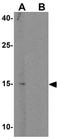Meiosis/Spermiogenesis Associated 1 antibody, GTX32017, GeneTex, Western Blot image 