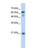 Germinal Center Associated Signaling And Motility antibody, NBP1-54596, Novus Biologicals, Western Blot image 