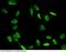 X-ray repair cross-complementing protein 6 antibody, 101116-T46, Sino Biological, Immunohistochemistry paraffin image 