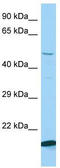 Kelch Repeat And BTB Domain Containing 2 antibody, TA333494, Origene, Western Blot image 