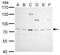 BCL6 Transcription Repressor antibody, PA5-27390, Invitrogen Antibodies, Western Blot image 