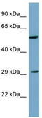 Dickkopf WNT Signaling Pathway Inhibitor 1 antibody, TA334532, Origene, Western Blot image 