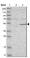 Mitogen-Activated Protein Kinase Kinase 5 antibody, NBP1-89654, Novus Biologicals, Western Blot image 
