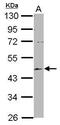 EMAP Like 2 antibody, GTX115761, GeneTex, Western Blot image 
