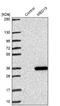 Mediator Complex Subunit 19 antibody, NBP1-81320, Novus Biologicals, Western Blot image 