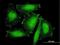 Sorbin and SH3 domain-containing protein 2 antibody, H00008470-B01P, Novus Biologicals, Immunocytochemistry image 