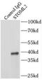 Stomatin-like protein 2 antibody, FNab08347, FineTest, Immunoprecipitation image 