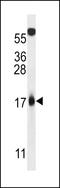 CDKN2A antibody, LS-C164218, Lifespan Biosciences, Western Blot image 