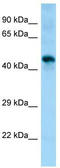 Phosphatidylcholine:ceramide cholinephosphotransferase 1 antibody, TA329766, Origene, Western Blot image 