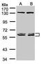 DnaJ homolog subfamily C member 7 antibody, TA307961, Origene, Western Blot image 