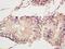 Bromodomain Adjacent To Zinc Finger Domain 1A antibody, orb2694, Biorbyt, Immunohistochemistry paraffin image 