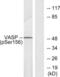 Vasodilator Stimulated Phosphoprotein antibody, LS-C117504, Lifespan Biosciences, Western Blot image 