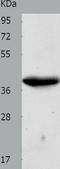 Cyclin Dependent Kinase 7 antibody, TA323115, Origene, Western Blot image 