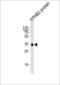 EPH Receptor B2 antibody, LS-C96481, Lifespan Biosciences, Western Blot image 