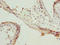 Ras-related protein Rab-5B antibody, LS-C676351, Lifespan Biosciences, Immunohistochemistry paraffin image 