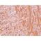 Bifunctional arginine demethylase and lysyl-hydroxylase JMJD6 antibody, LS-C108584, Lifespan Biosciences, Immunohistochemistry frozen image 