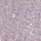 Zinc finger protein neuro-d4 antibody, PA5-61895, Invitrogen Antibodies, Immunohistochemistry paraffin image 