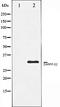 Histone Deacetylase 2 antibody, orb106515, Biorbyt, Western Blot image 