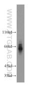 ATPase H+ Transporting Accessory Protein 1 antibody, 15305-1-AP, Proteintech Group, Western Blot image 