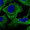 Plectin antibody, HPA025967, Atlas Antibodies, Immunofluorescence image 
