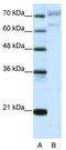 Protein AATF antibody, TA343683, Origene, Western Blot image 