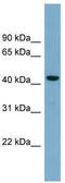 Cell Division Cycle Associated 7 Like antibody, TA344836, Origene, Western Blot image 