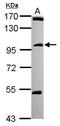 Coiled-Coil Domain Containing 178 antibody, PA5-31601, Invitrogen Antibodies, Western Blot image 